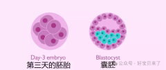 囊胚级别4bc和5bc是什么？什么样的不孕患者适合进行囊胚培养？