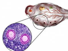 为什么基础卵泡数量与取卵数量存在差异？HRC专家答疑！