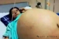 陕西27岁孕妈剖腹产三胞胎，结果护士抱出四个！性别让宝爸更无语