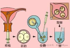 揭秘！试管婴儿成功率高的人，都有这7个特点！