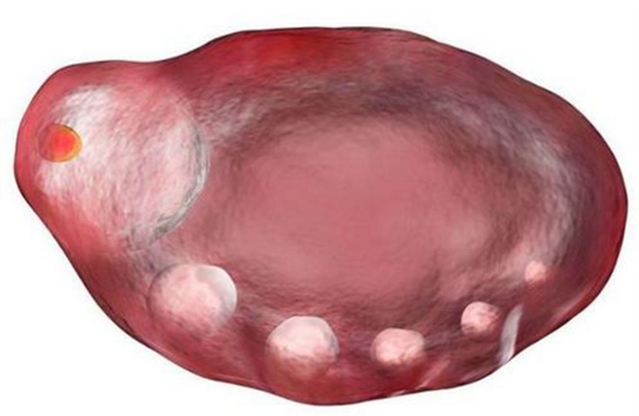 卵泡发育不良