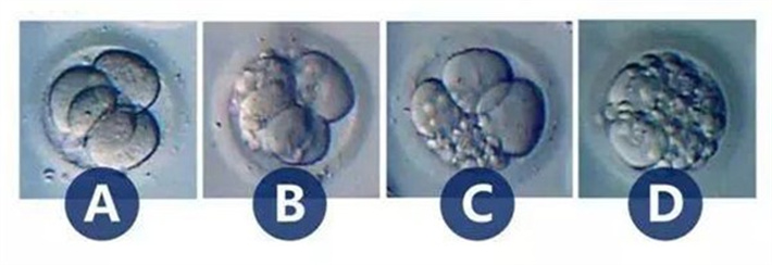 胚胎等级